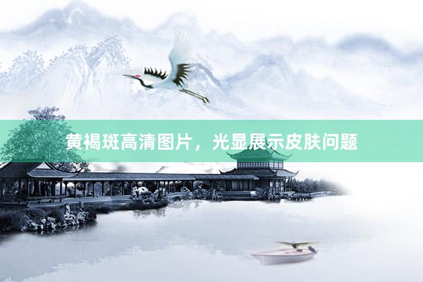 黄褐斑高清图片，光显展示皮肤问题